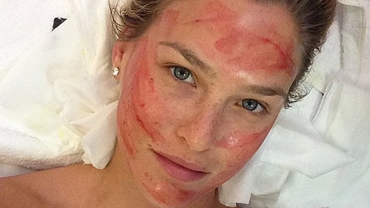 בר רפאלי מרוחה בדם