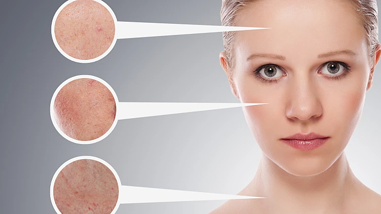 עור פנים בעייתי