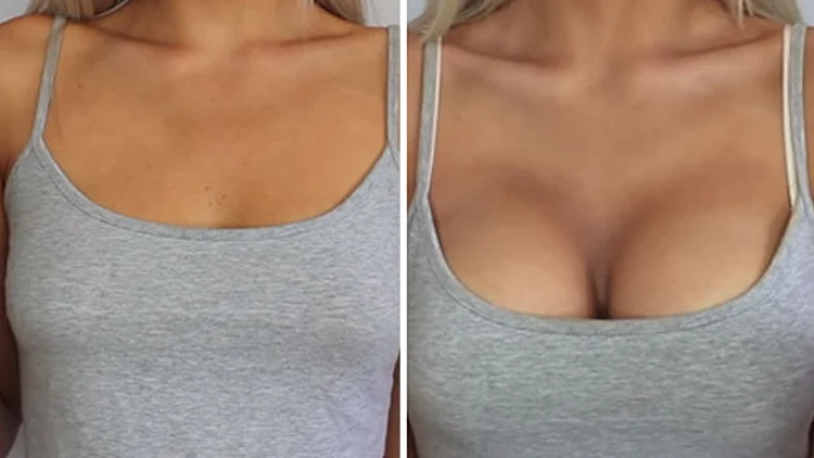 בלי ניתוחים: הטריק שיגדיל את החזה ברגע