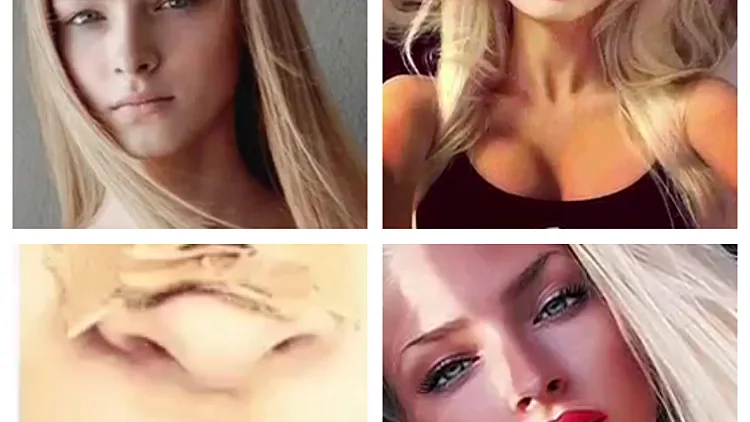 כוכבות האינסטגרם המנותחות