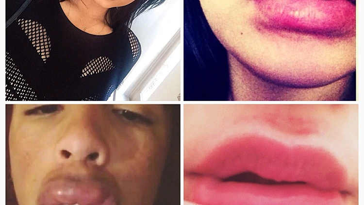 טרנד השפתיים המשתלט