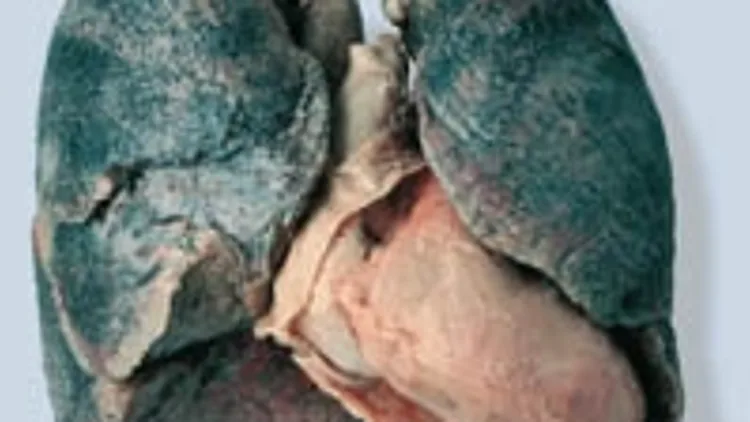 ריאות מתוך תערוכת עולמות הגוף