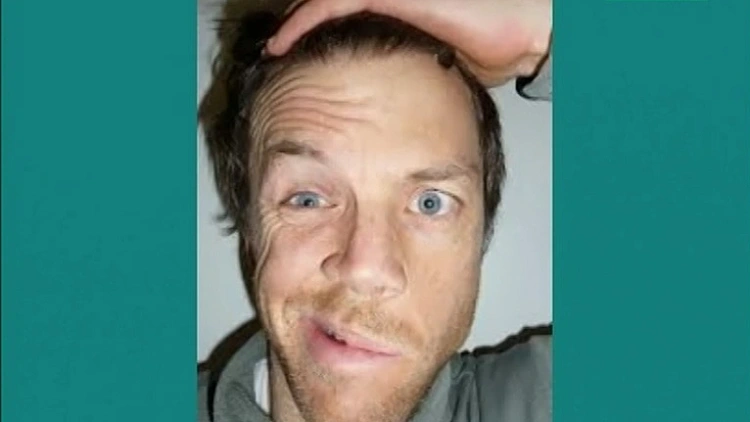 ההפרעה בעצב הפנים