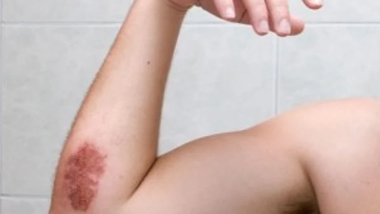 שושנת יריחו