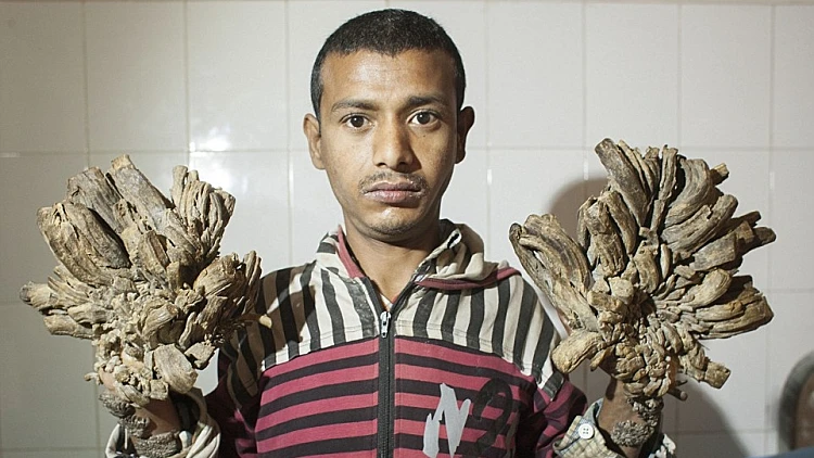 האיש שהופך לעץ