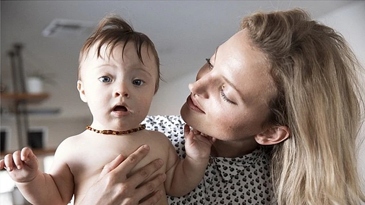 הדוגמנית שבנה סובל מתסמונת דאון