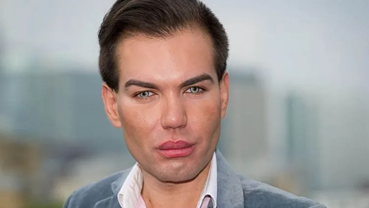 דייל ברזילאי השקיע כ-100 אלף ליש"ט כדי להגשים את חלומו. למרות שהניתוח האחרון סיכן את חייו, הוא מתכנן לשכב שוב על שולחן הניתוחים (ערוץ WTF)