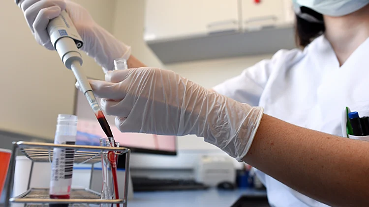 מניין החולים מקורונה עלה ל-14,882 חולים – מהם 107 מונשמים | חדשות 13