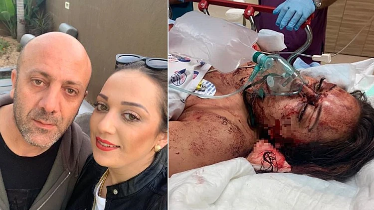 ליאנה חזן, ששרדה ניסיון רצח עי בעלה