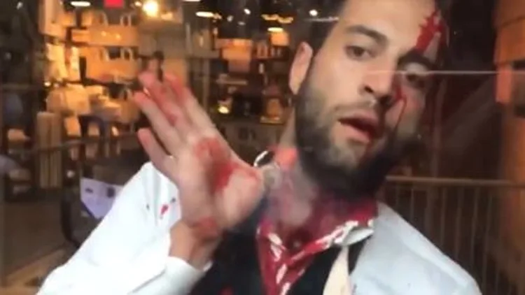 לא רק בישראל: יהודי עבר לינץ' בלב מנהטן • תיעוד