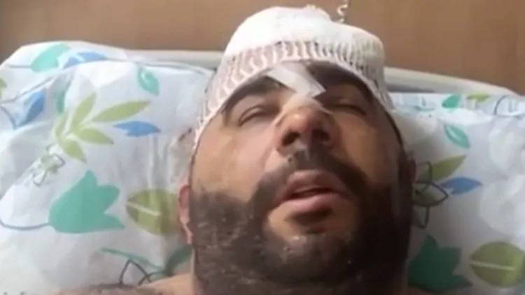 "דפקו לי סכינים בראש": הצעיר שעבר לינץ' משחזר את רגעי האימה