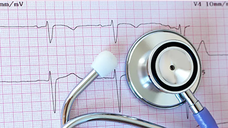 סימנים להתקף לב, שחל