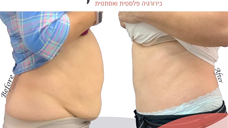 ד"ר מנאר קעואר – מומחה בכירורגיה פלסטית – בדרך  ליצירת יופי אנושי ולא "פלסטי" | רשת 13