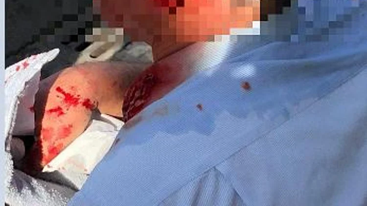 נהג אוטובוס שהותקף בצפת