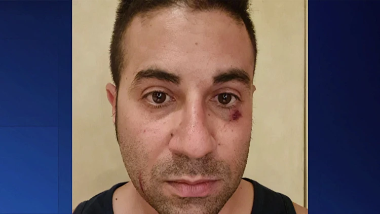 אילת: ביקש מנער לעטות מסכה - והוכה לעיניי ילדיו