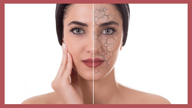 והרי התחזית לחורף זה: עור יבש | רשת 13