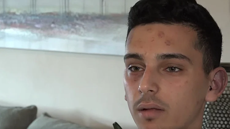 הנער שספג אלימות משוטרים: "כל מה שעניין אותם זה מי בועט חזק יותר"