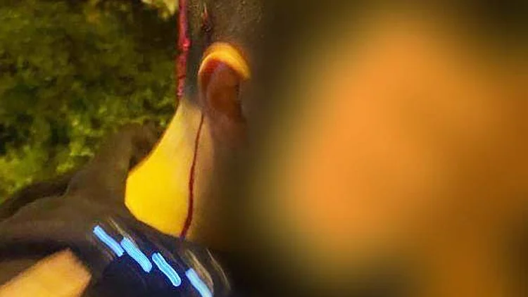 בגלל שריפת צעיף: אוהד בית"ר בן 17 נדקר ע"י אוהדי מכבי ת"א