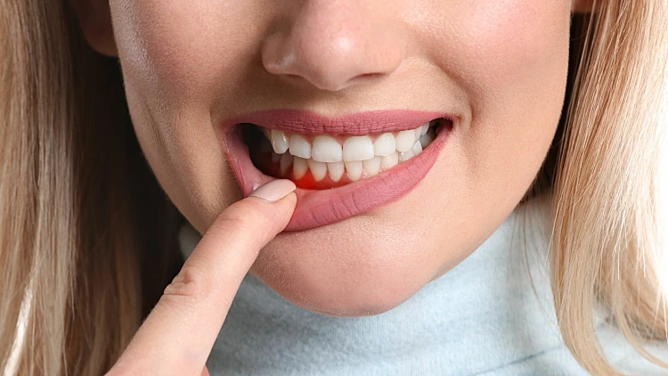 מחלות חניכיים | רשת 13