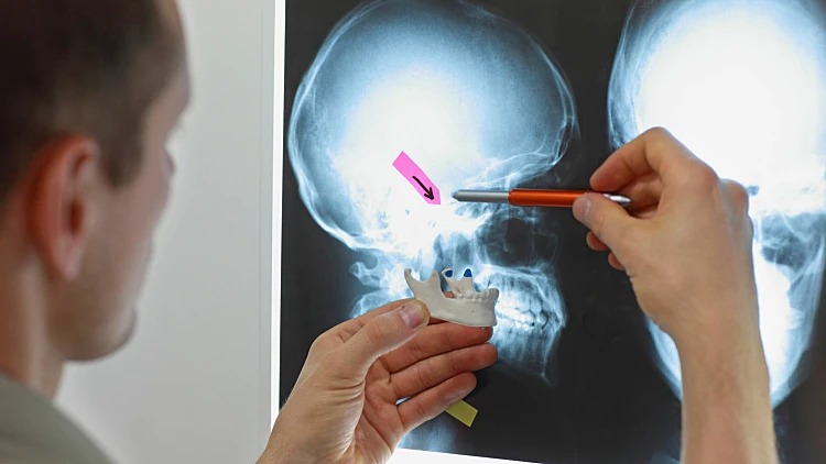 רעשים וקליקים במפרקי הלסתות | רשת 13