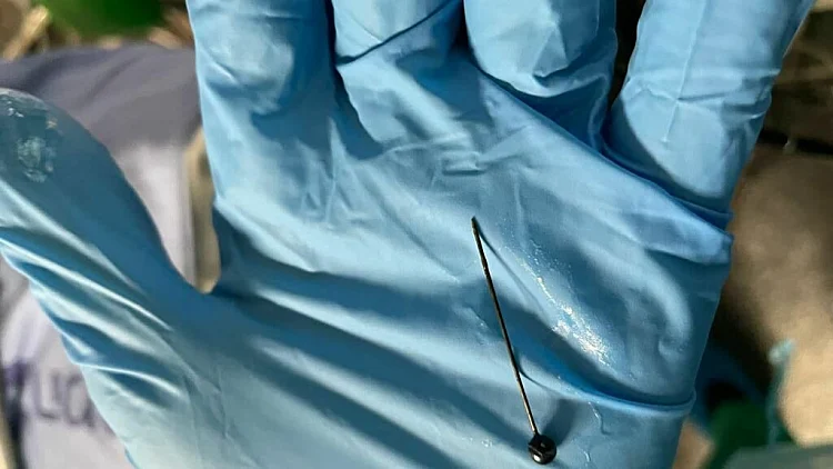 הסיכה שננעצה בדופן קיבתה של נערה