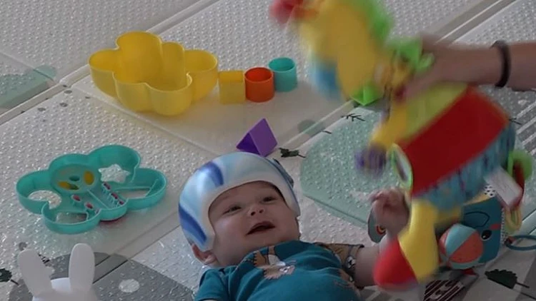 התסמונת שמאלצת ילדים לחבוש קסדה - הפכה ללהיט ברשת