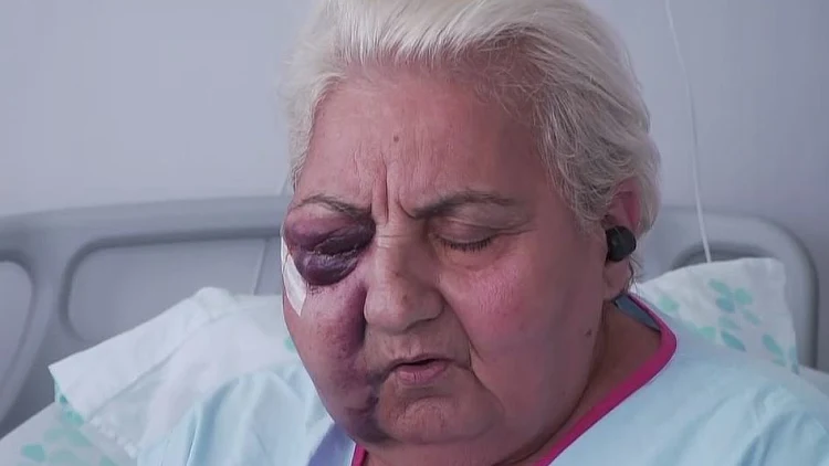 "יצאתי בנס": הפצועה מפיגוע אבנים משחזרת את רגעי האימה