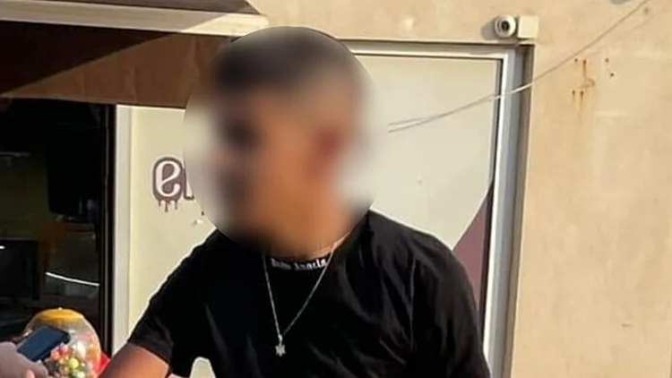 בת 4 נדרסה ע"י רוכב אופניים חשמליים. אביה: "לא עצר לעזור"