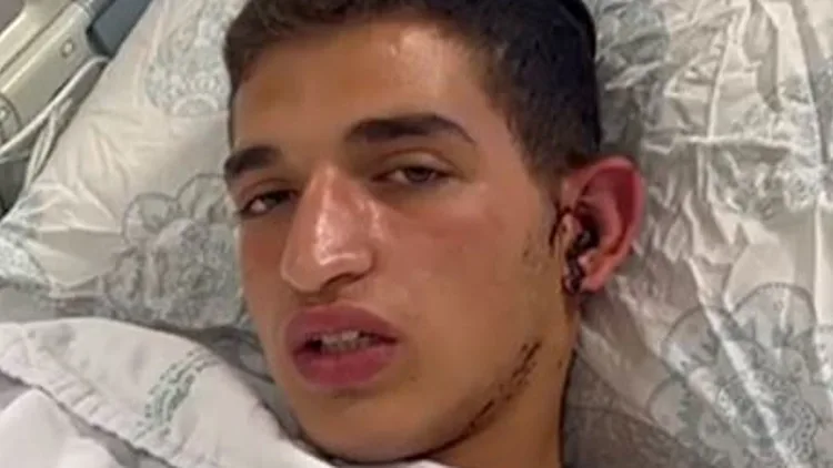חברו של אריה, שנרצח בפיגוע בי-ם: "דיברנו - ואז היה פיצוץ"