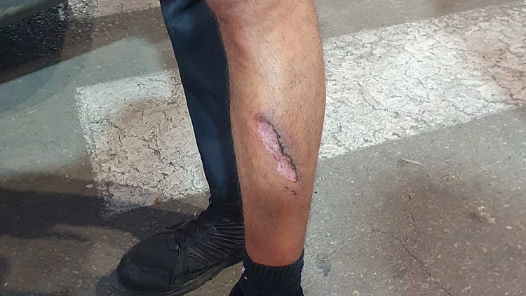 פציעתו של השוטר