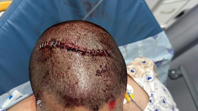 אורין בניאן, החייל שנפצע כשניסה להפריד בקטטה בין נערים