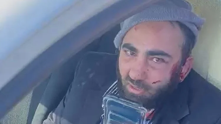 נכנס לקלנדיה והותקף: גבר נפצע קל בראשו מיידוי אבנים