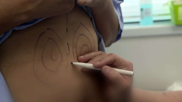 "מאמי-מייקאובר": טרנד הניתוחים הפלסטיים שכובש את האימהות