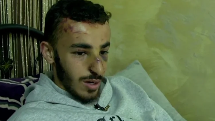 תיעוד חריג ממזרח י-ם: שוטרים שהגיעו לזירת תאונה ירו באוויר