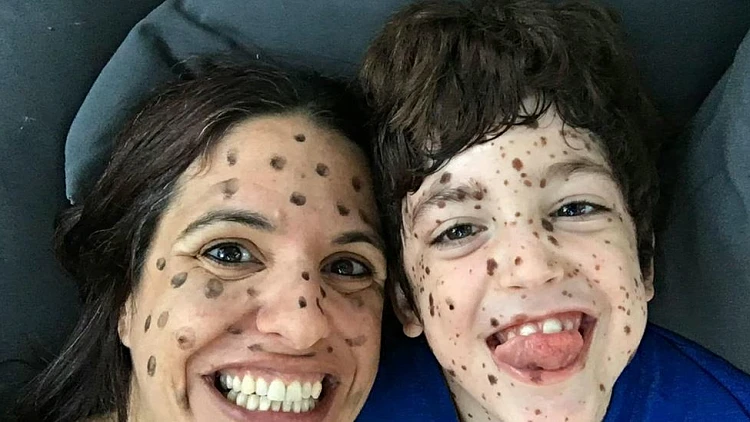 "הילד עם הנקודות" מגיע לבמה: "הבאנו את האמת לפרצוף, לא חסכנו"