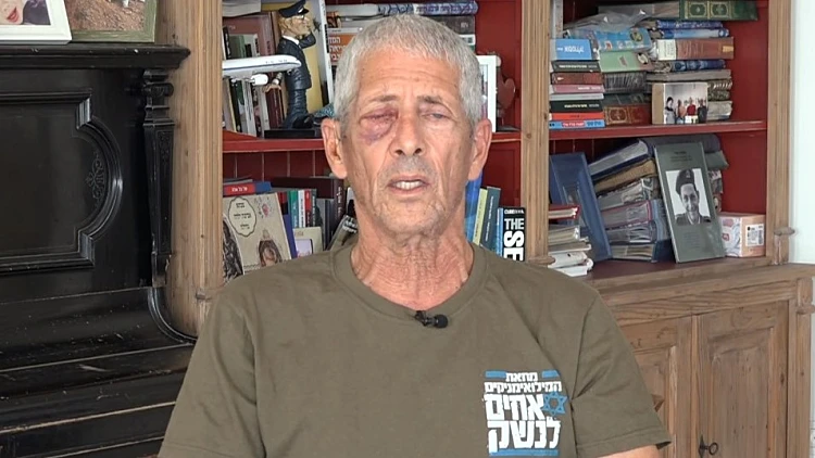 המפגין שנפגע בעינו ממכתז"ית: "לא איבדתי את העין, פייק מוחלט"