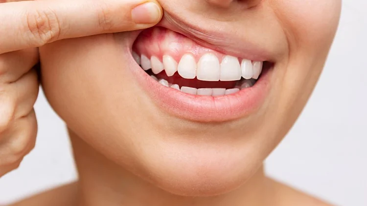 Istock 1356771196888888