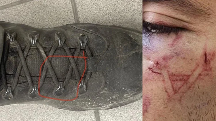 השוטר שחשוד בהטבעת מגן דוד על עצור שוחרר למעצר בית