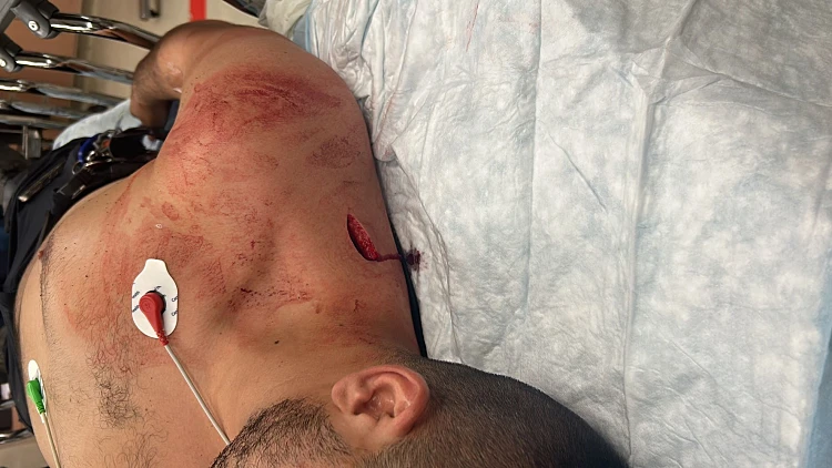 דובר המשטרה על דקירת השוטר: "אירוע חמור, נחצה קו אדום"