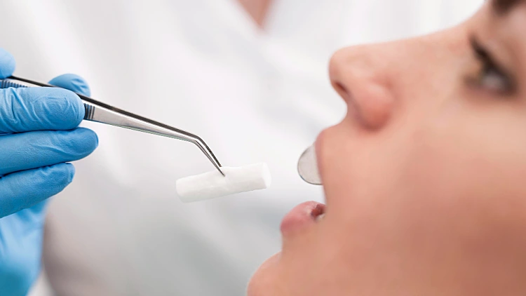 אילוסטרציה