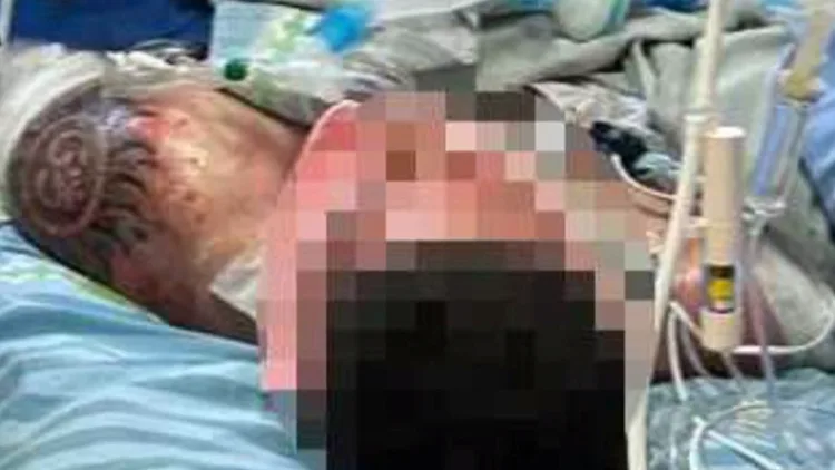 "קיבל הזדמנות שנייה": הניצול מהאסון בעזה - והקעקוע ששרד