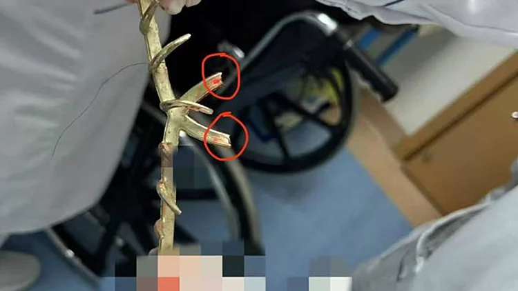 אישה עם קליפס בשיער נפגעה ממכונית נוסעת וזה מה שקרה לה