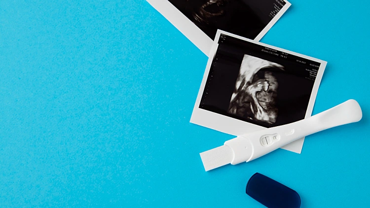 אילוסטרציה