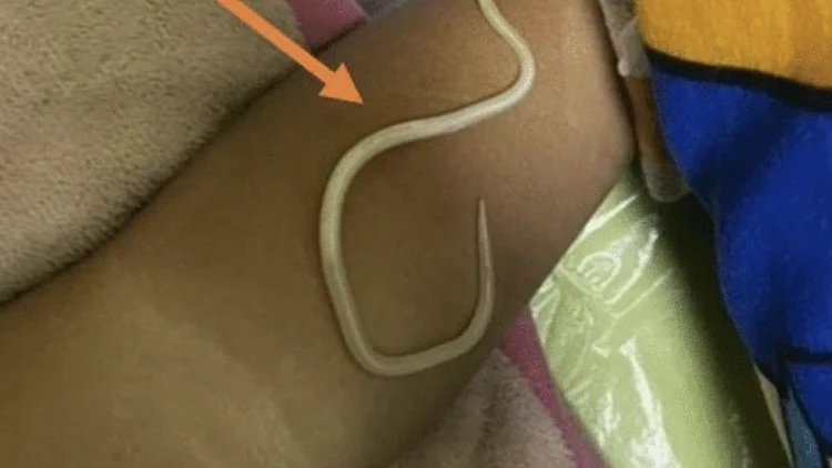 Journal Of Medical Case Report