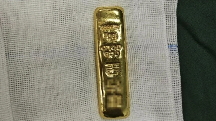 לא כל הנוצץ הוא קבב: בן 11 בלע מטיל זהב במשקל 100 גרם
