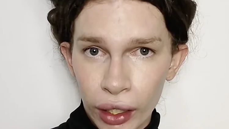 הטרנסג'נדרית שהוציאה אלפי דולרים כדי להפוך לחתול התחרטה