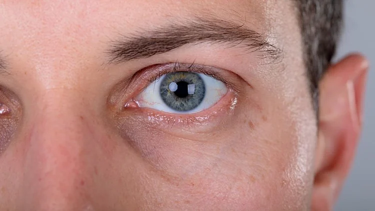 אילוסטרציה