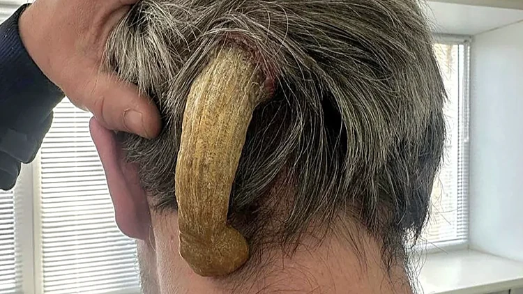 Horn 3