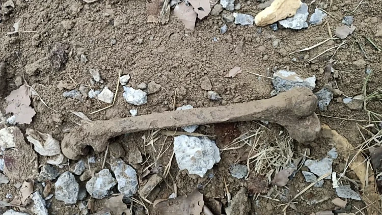 Bones2
