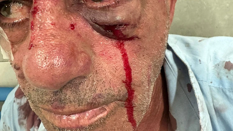 נהג האוטובוס שהותקף בטבריה